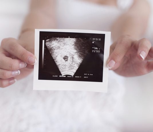 Bør man kunne se hjertet slå til en scanning i uge 6