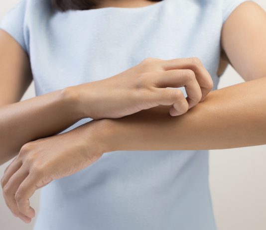 Er det farligt når det klør over hele kroppen og man er gravid?