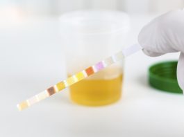 Er det skadeligt hvis der er ketoner i urinen og man er gravid? Er det skadeligt hvis der er ketoner i urinen og man er gravid i uge 13?