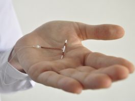 Hvor hurtigt kan jeg blive gravid efter min kobberspiral bliver fjernet?