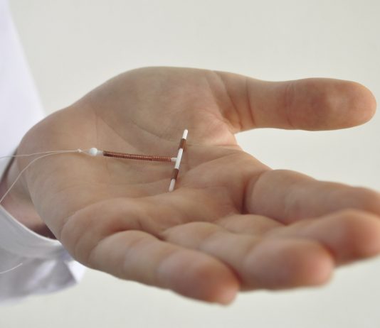 Hvor hurtigt kan jeg blive gravid efter min kobberspiral bliver fjernet?
