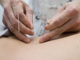 Kan akupunktur hjælpe os med at blive gravide?