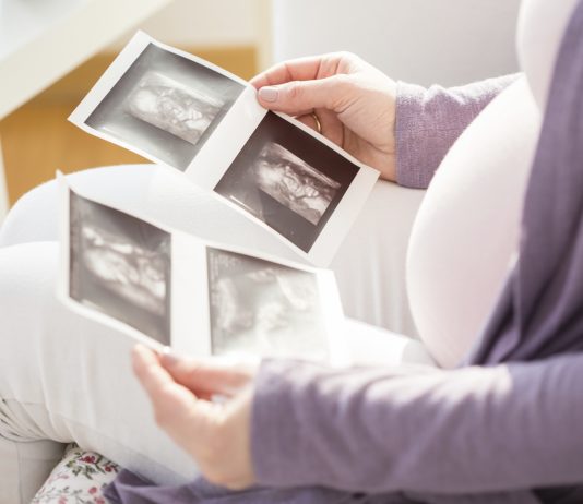 Jeg er nervøs efter min misdannelsesscanning. Kan mit barn være handicappet?
